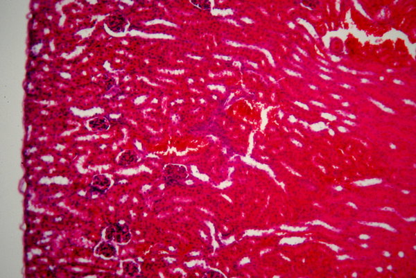 Kidney - microscopic view - ho