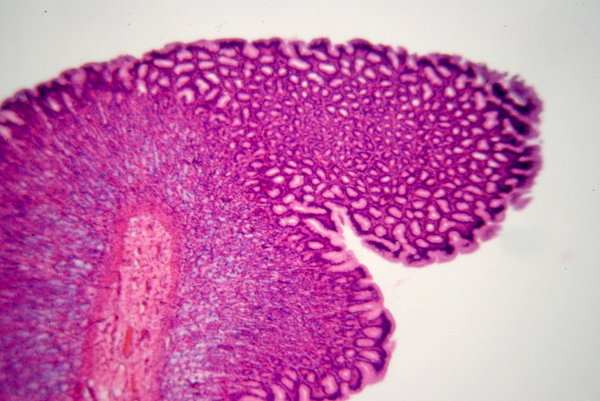 Human's stomach - microscopic 