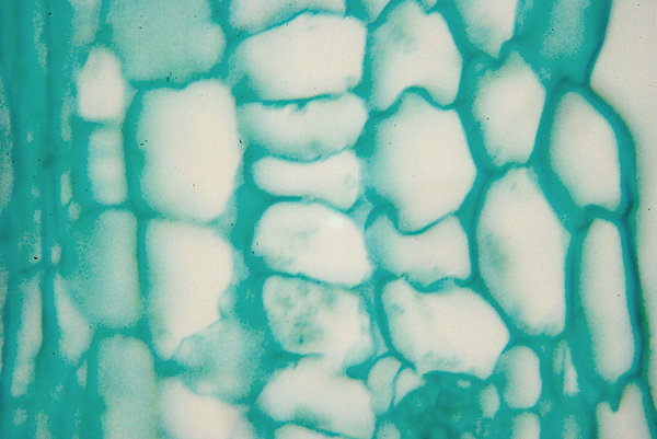 Microscopic view of pumpkin 4: View of pumpkin's stalk; magnification 100, 500, 1000 x