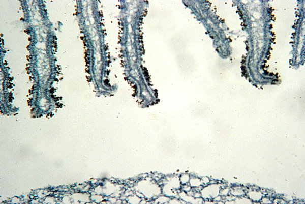 Fungus - microscopic view of s
