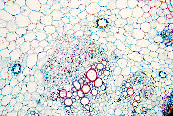 Sunflower leaf - microscopic v