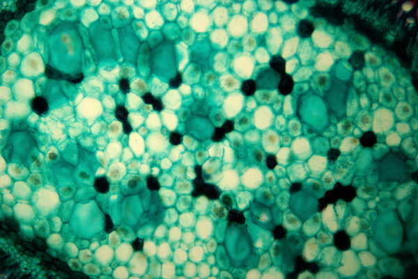 Lime tree - microscopic view 3